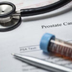 New research shows little risk of infection from prostate biopsies